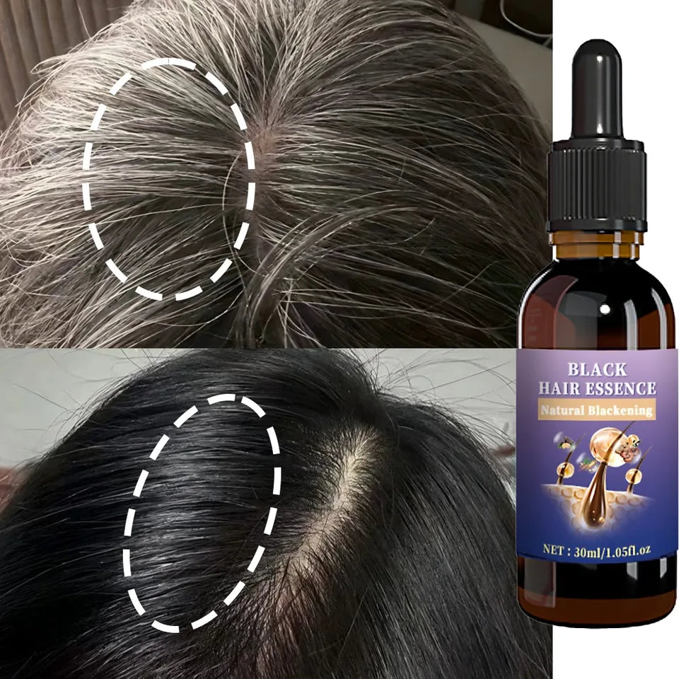 Black Hair Essence - Deep Scalp Nourishment & Hair Strengthening, Supports Healthy Hair Tone