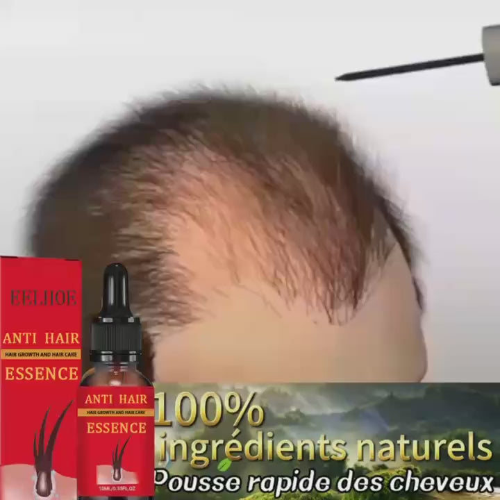 99% of buyers buy again, have more and more hair, say goodbye to baldness, thick hair,Hot selling product